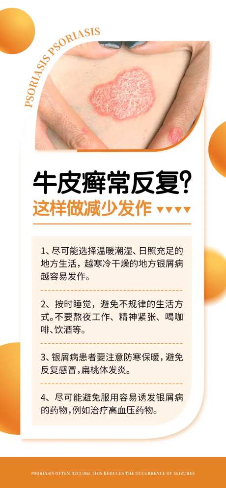 牛皮癣科普常识-采灵感-https://www.cailinggan.com/