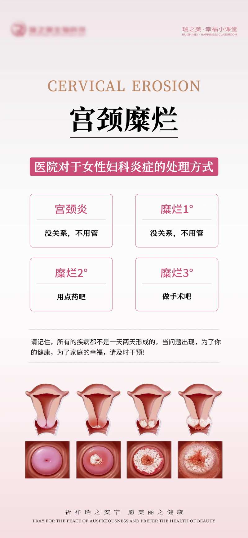 私密宫颈养护-采灵感-cailinggan.com