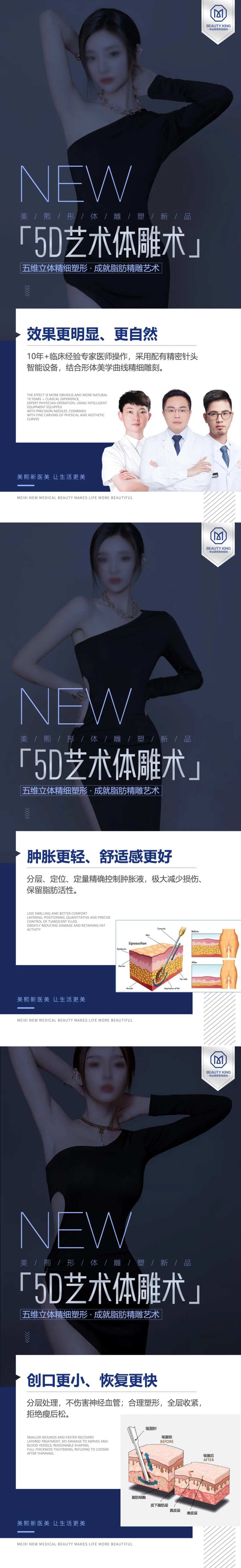体雕新品技术优势亮点海报-采灵感-cailinggan.com