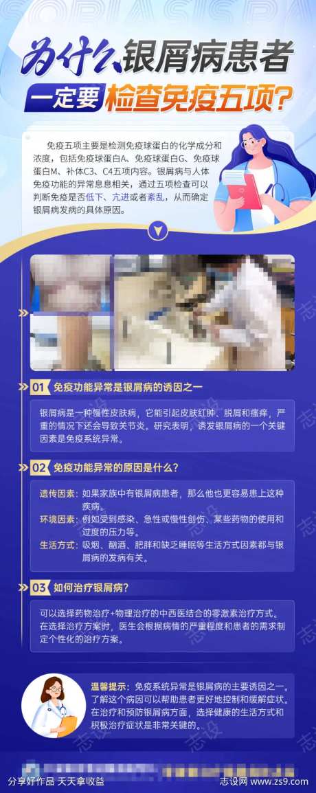 为什么银屑病患者一定要检查免疫五项-采灵感-https://www.cailinggan.com/