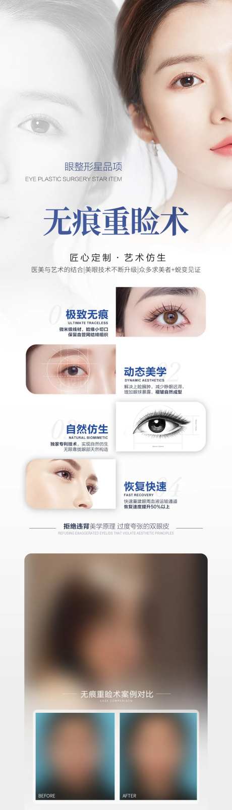 无痕重睑术宣传海报-采灵感-https://www.cailinggan.com/