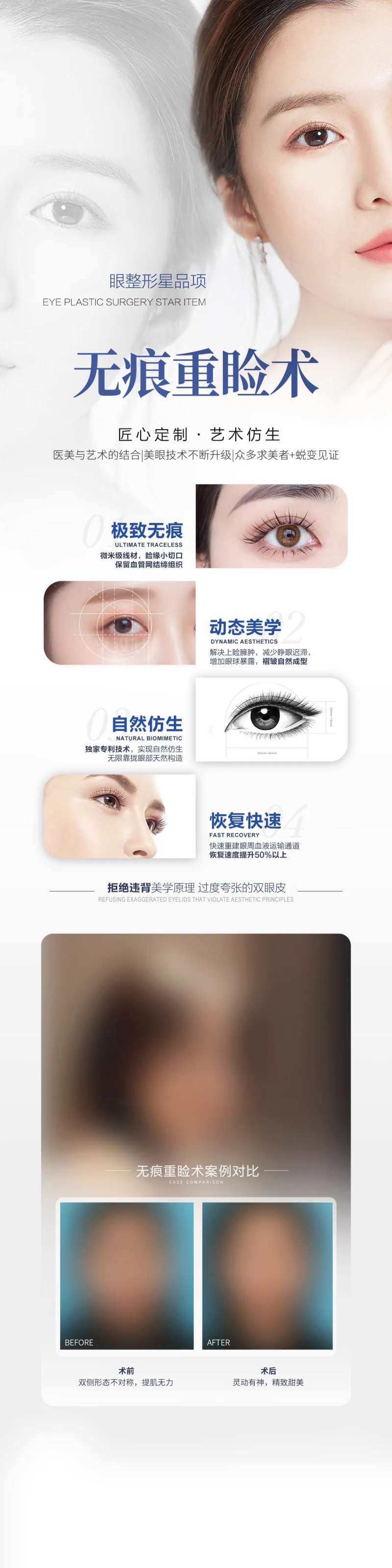 无痕重睑术宣传海报-采灵感-cailinggan.com
