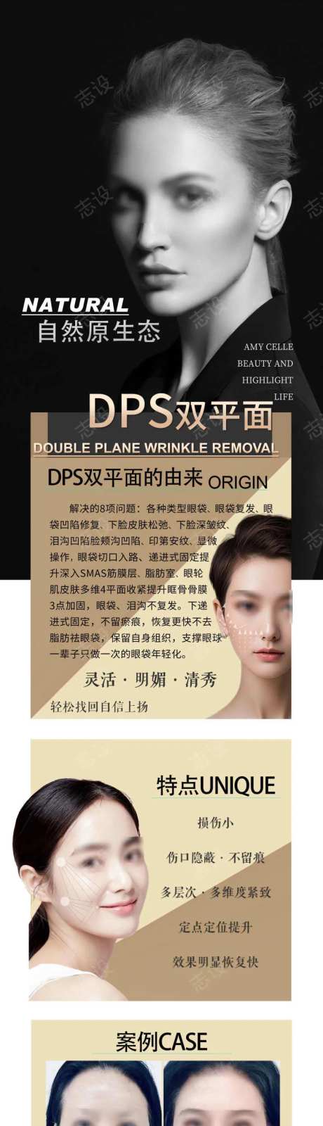 DPS双平面提升-采灵感-https://www.cailinggan.com/