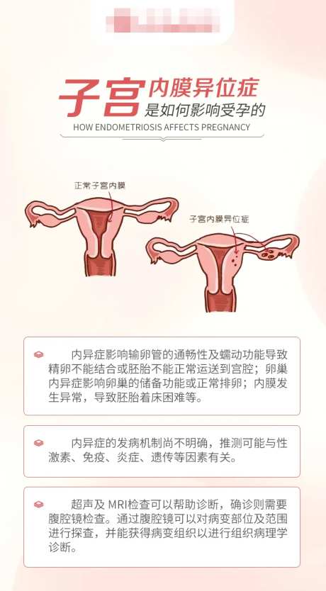 子宫内膜异位症如何影响受孕海报-采灵感-https://www.cailinggan.com/