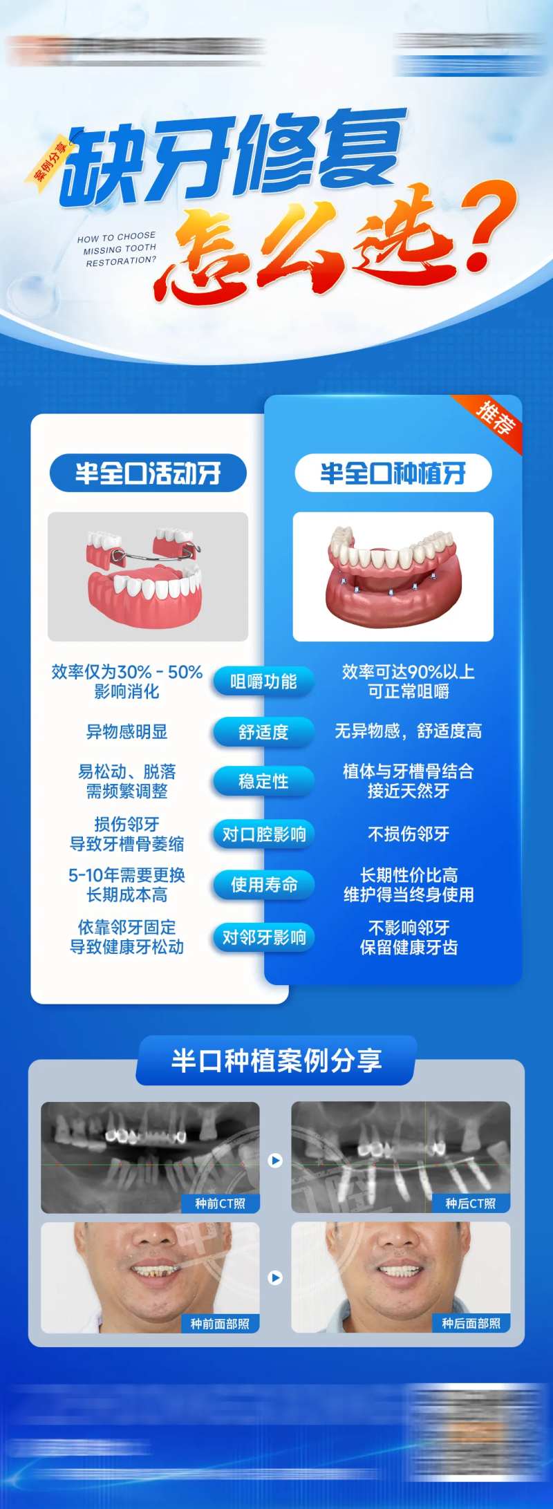 缺牙修复怎么选海报-采灵感-cailinggan.com