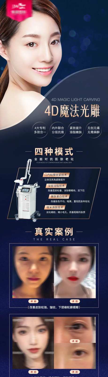 医美fotona4d案例长图-采灵感-https://www.cailinggan.com/