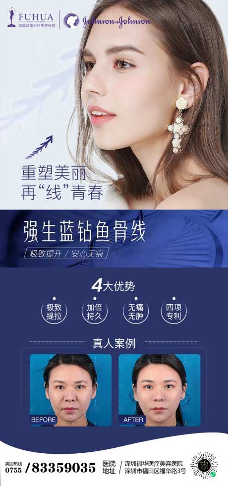 医美强生鱼骨线线雕海报-采灵感-https://www.cailinggan.com/