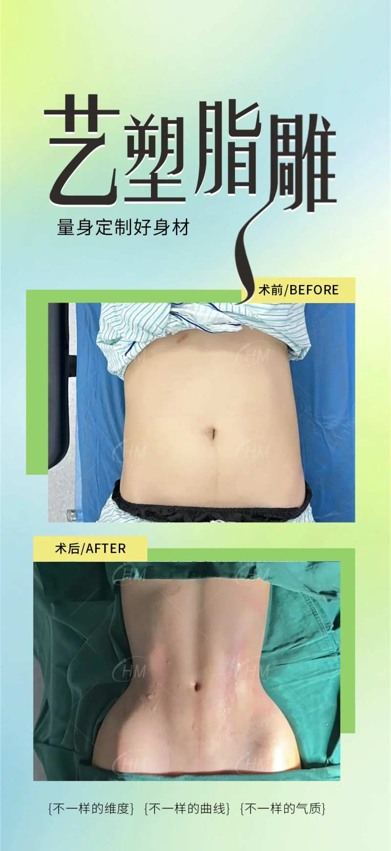 医美艺塑脂雕海报-采灵感-cailinggan.com