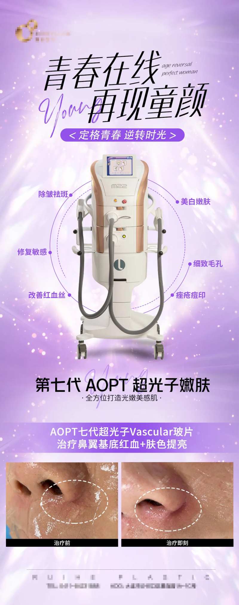 医美仪器效果对比-采灵感-cailinggan.com