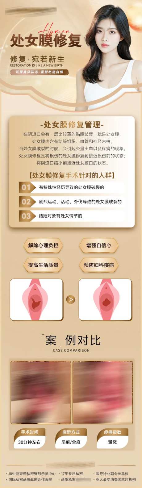 处女膜修复案例长图-采灵感-https://www.cailinggan.com/