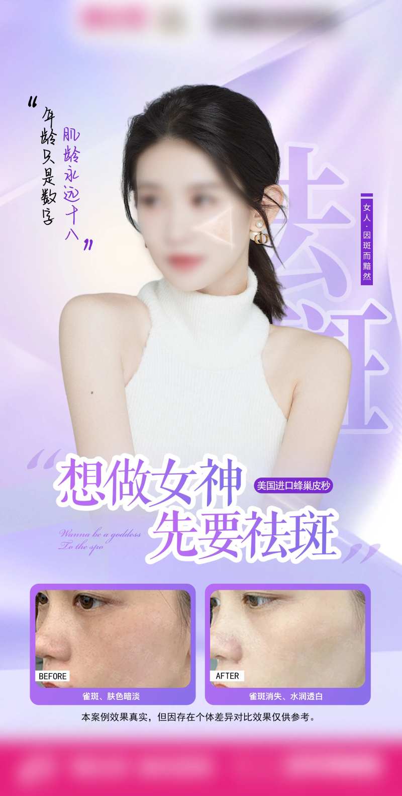 蜂巢皮秒海报-采灵感-cailinggan.com