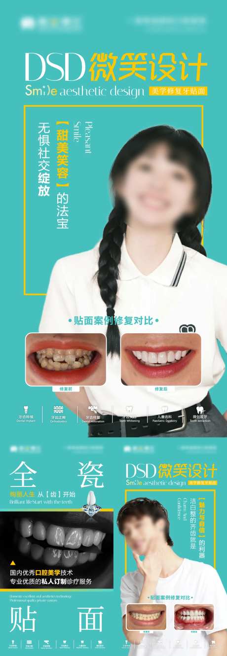 牙贴面美牙海报-采灵感-https://www.cailinggan.com/