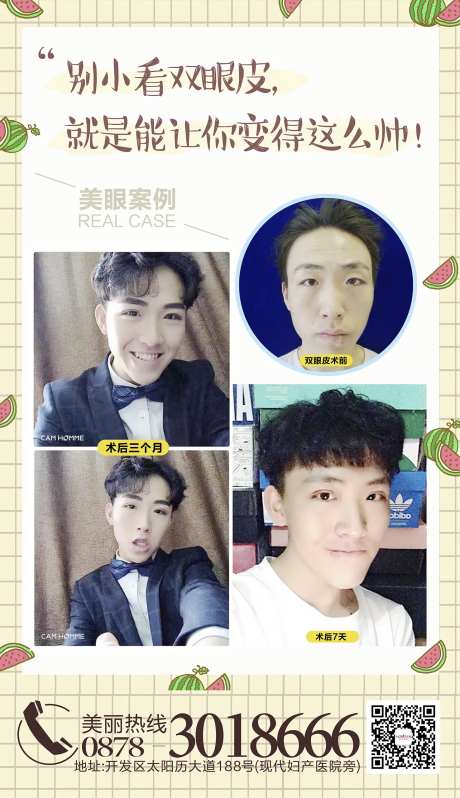 双眼皮对比图医美海报-采灵感-https://www.cailinggan.com/
