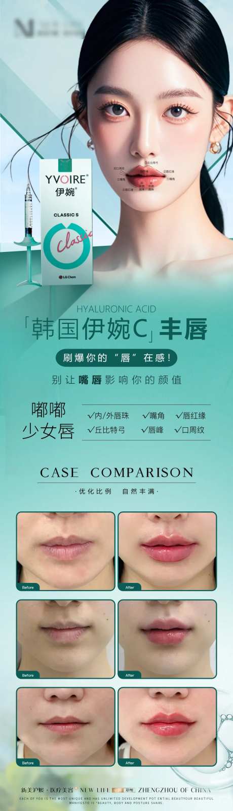 医美伊婉c针剂轻医美丰唇项目长图海报-采灵感-https://www.cailinggan.com/