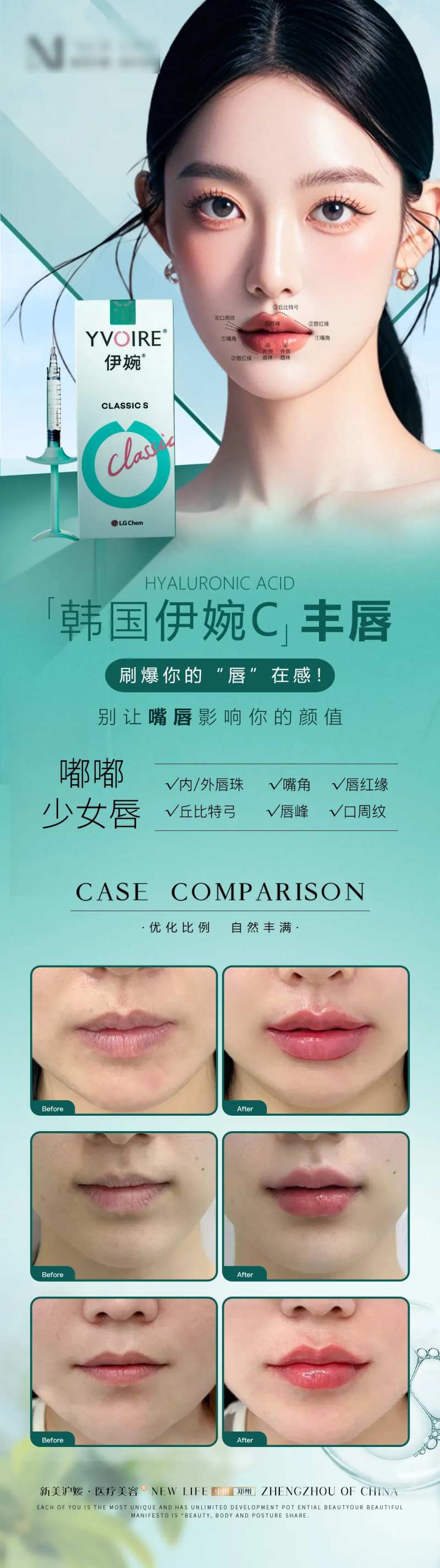 医美伊婉c针剂轻医美丰唇项目长图海报-采灵感-cailinggan.com