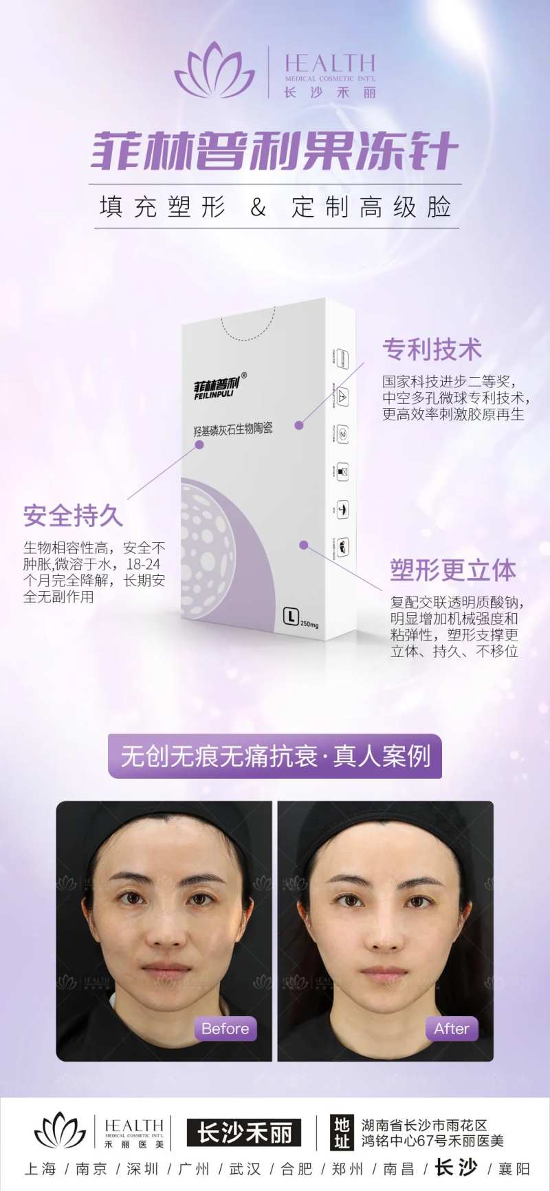 医美-菲林普利果冻针-采灵感-cailinggan.com