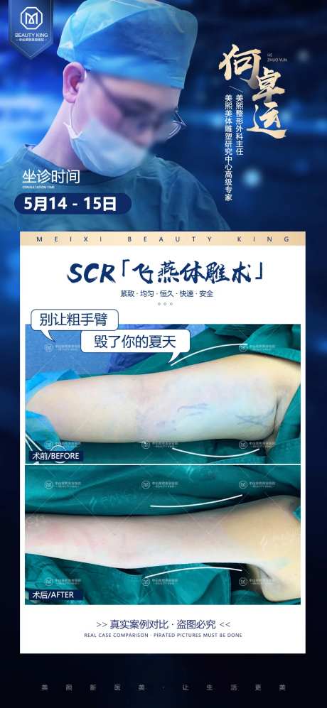 抽脂医生坐诊案例海报-采灵感-https://www.cailinggan.com/