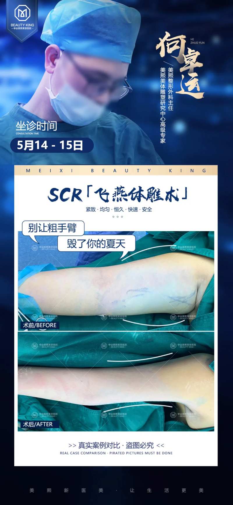 抽脂医生坐诊案例海报-采灵感-cailinggan.com