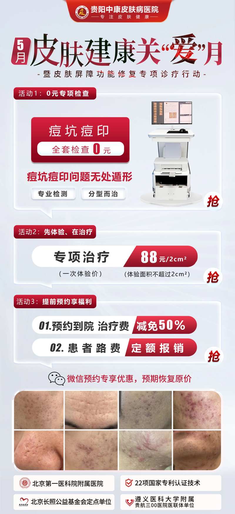 医美痘坑痘印-采灵感-cailinggan.com