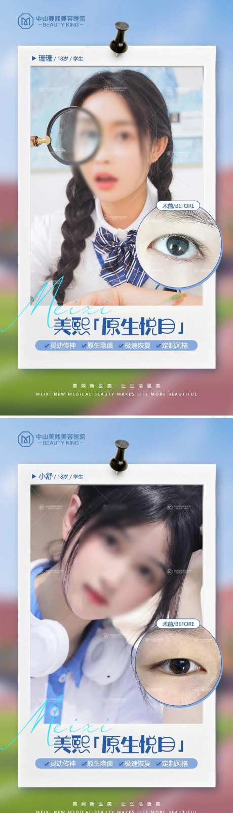 毕业季双眼皮案例海报-采灵感-https://www.cailinggan.com/