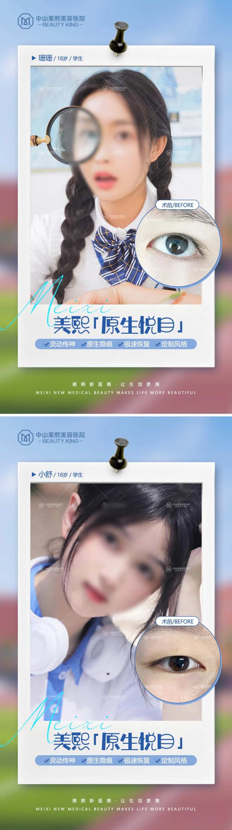 毕业季双眼皮案例海报-采灵感-cailinggan.com