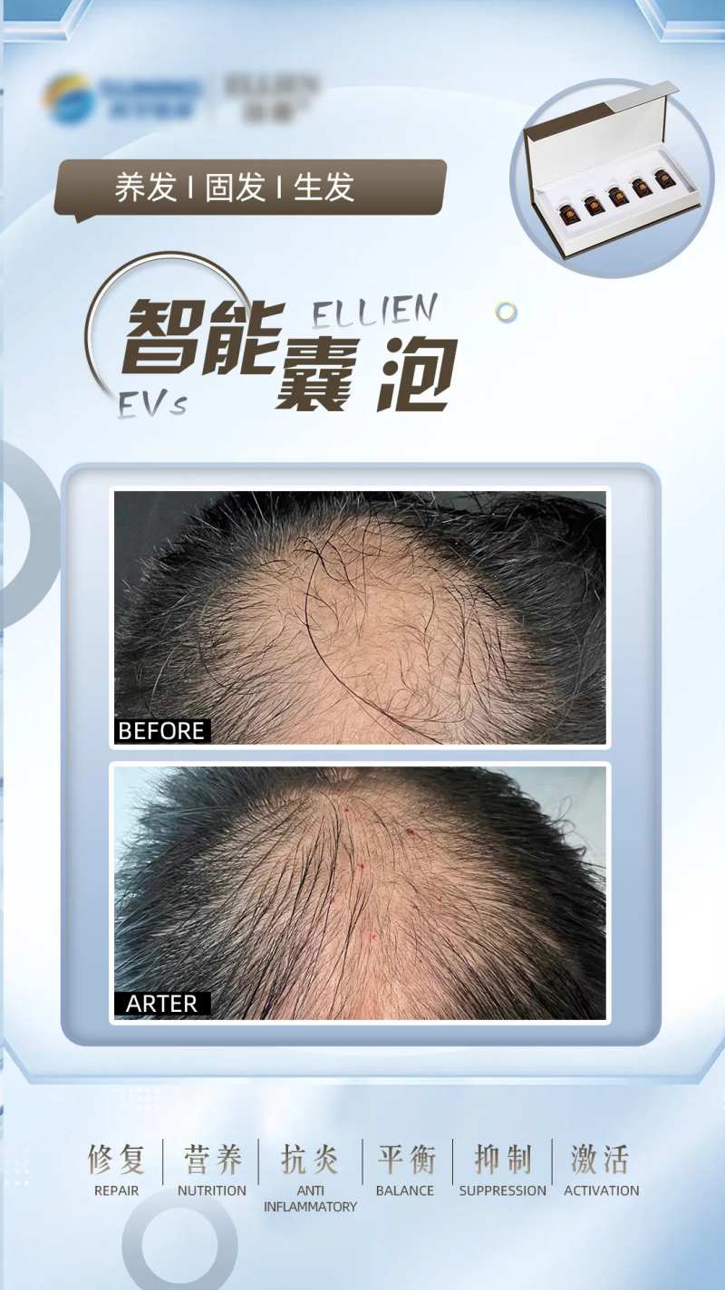 毛发生发案例-采灵感-cailinggan.com