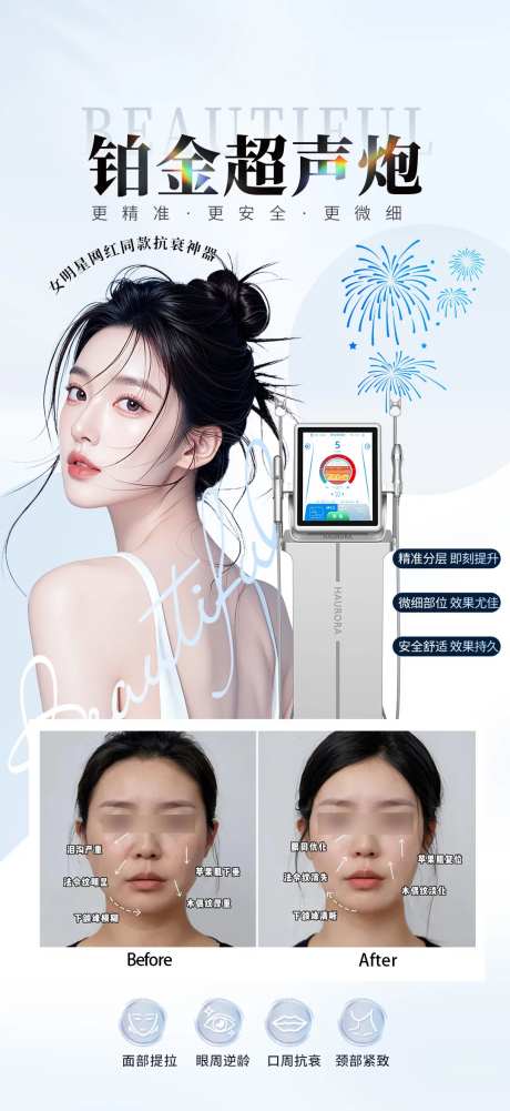 铂金超声炮案例-采灵感-https://www.cailinggan.com/