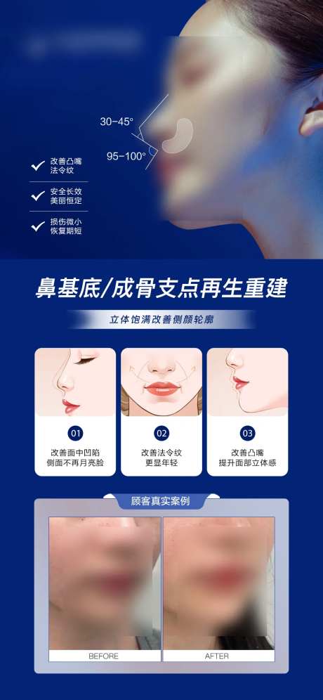 医美鼻基底填充案例海报-采灵感-https://www.cailinggan.com/