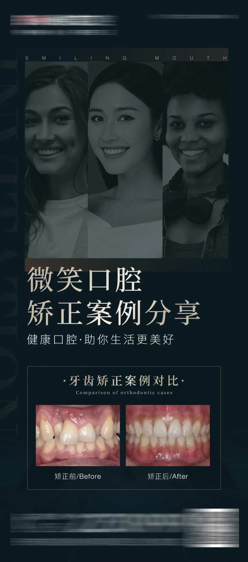 医美口腔矫正案例对比海报-采灵感-cailinggan.com