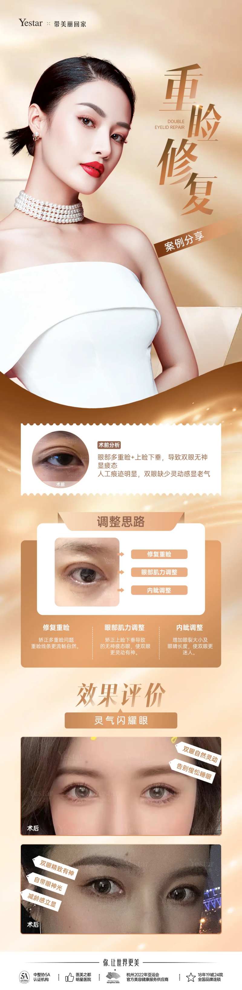 外科眼修复长图-采灵感-cailinggan.com