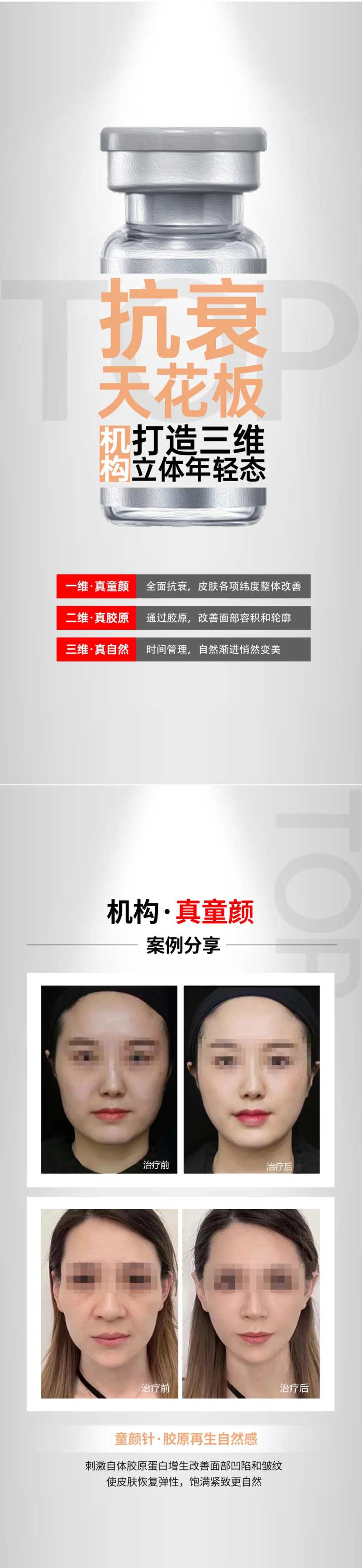 医美艾维岚胶原蛋白海报                                                                                                                                                                                             -采灵感-cailinggan.com