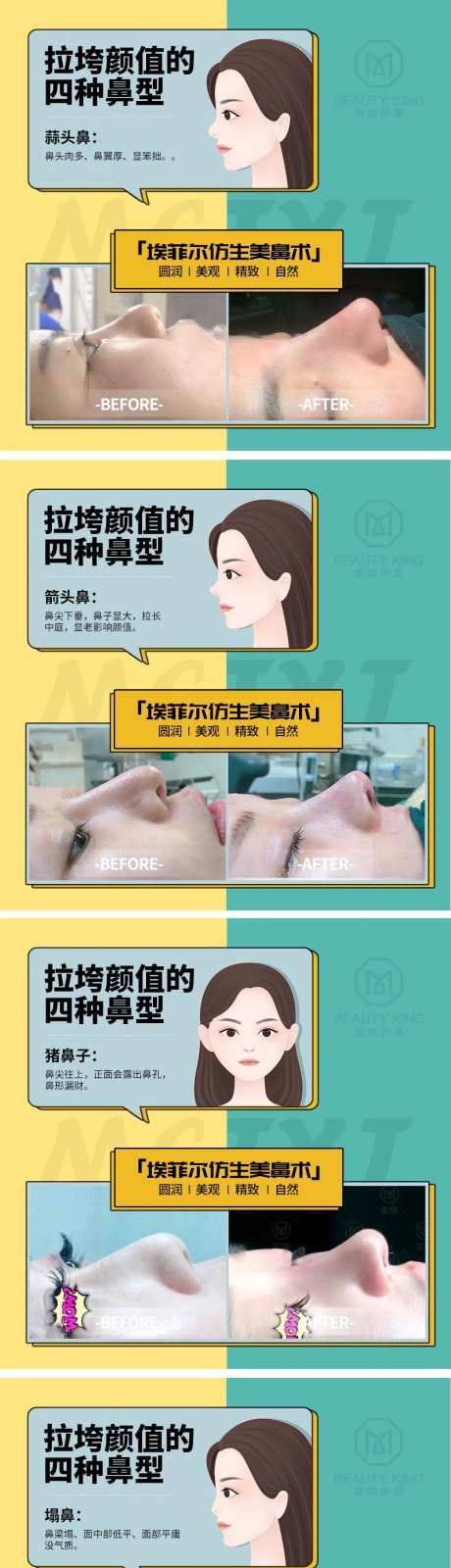 隆鼻助推海报-采灵感-https://www.cailinggan.com/