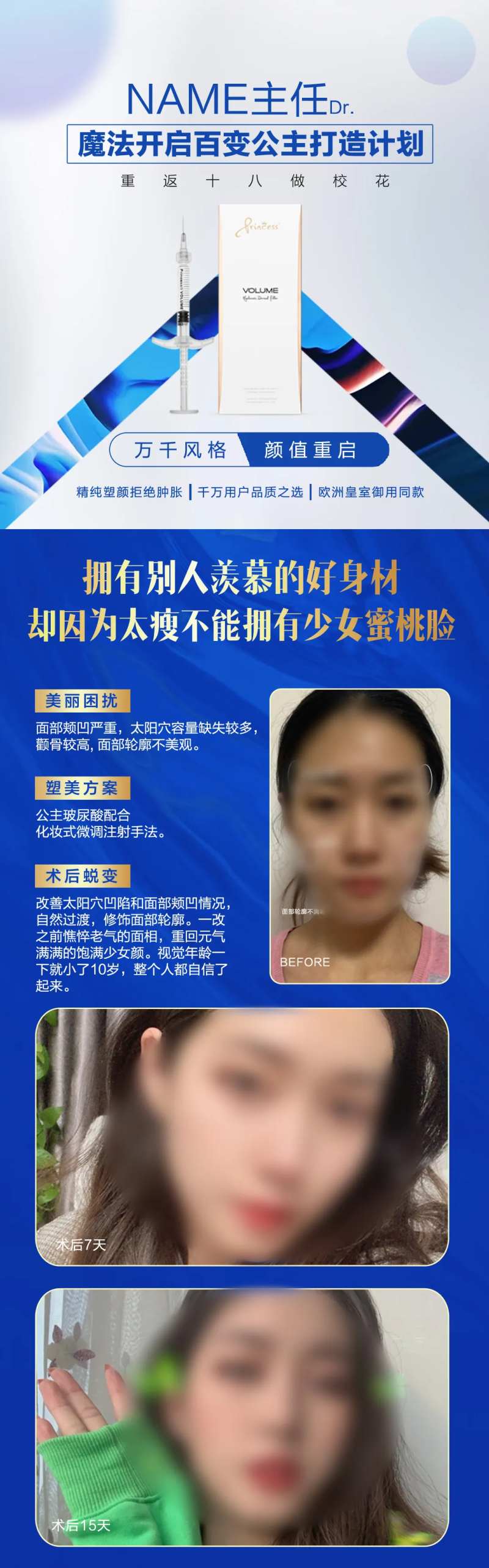 公主玻尿酸案例海报-采灵感-cailinggan.com