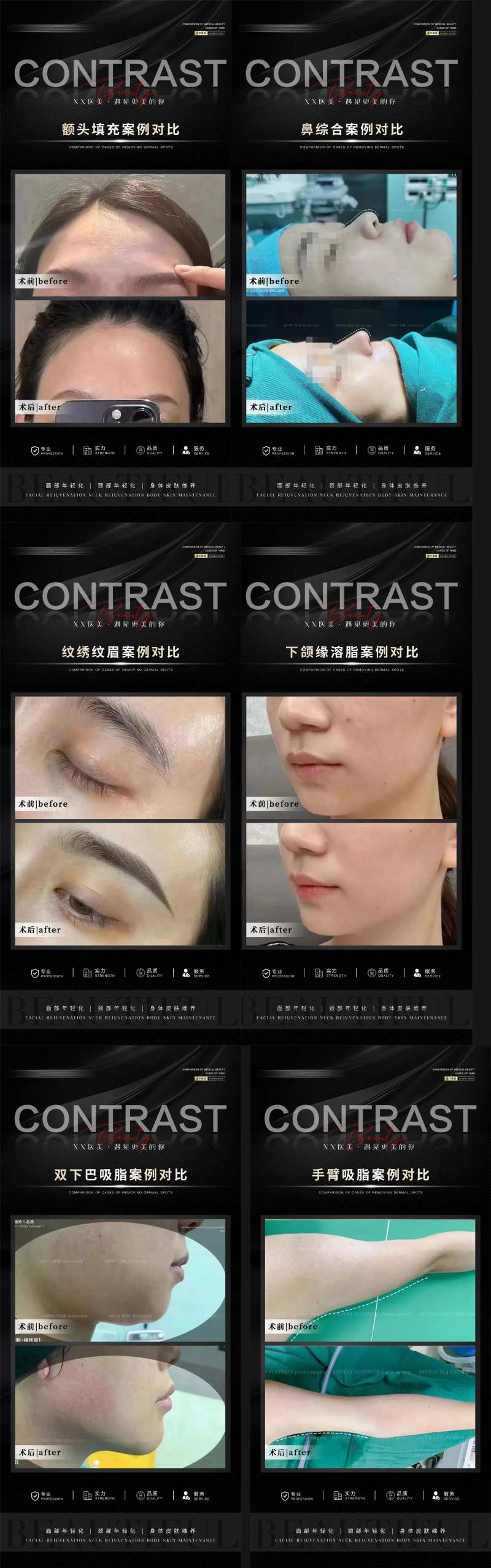 整形案例合集-采灵感-cailinggan.com