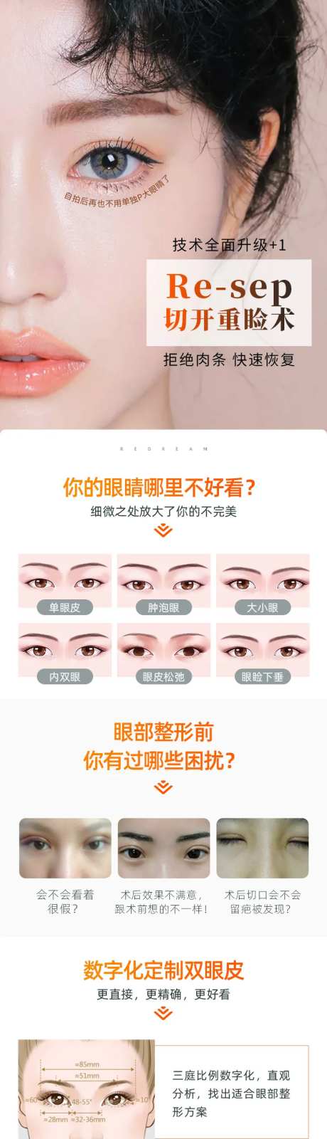 切开双眼皮-采灵感-https://www.cailinggan.com/