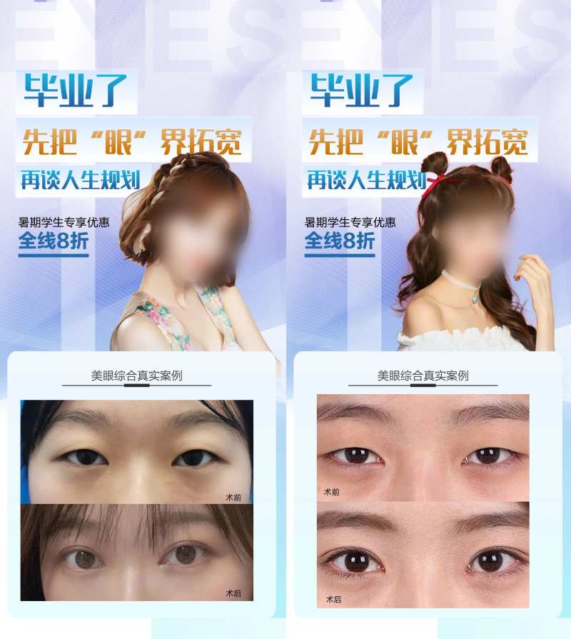 暑期医美促销海报-采灵感-cailinggan.com