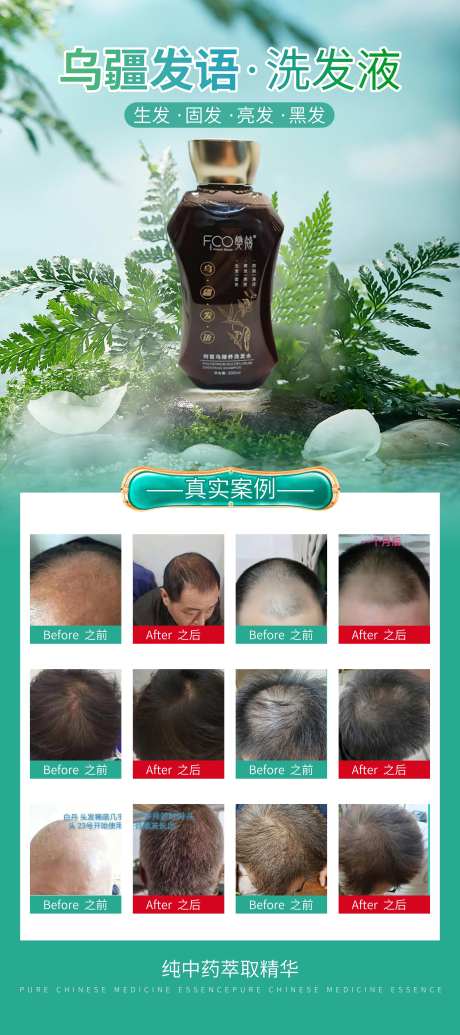 生发液案例海报-采灵感-https://www.cailinggan.com/