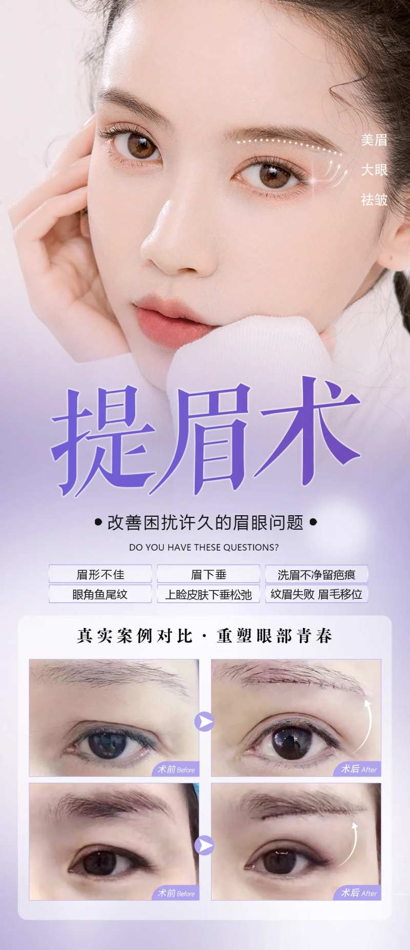 提眉眼部医美真人整形案例海报-采灵感-cailinggan.com