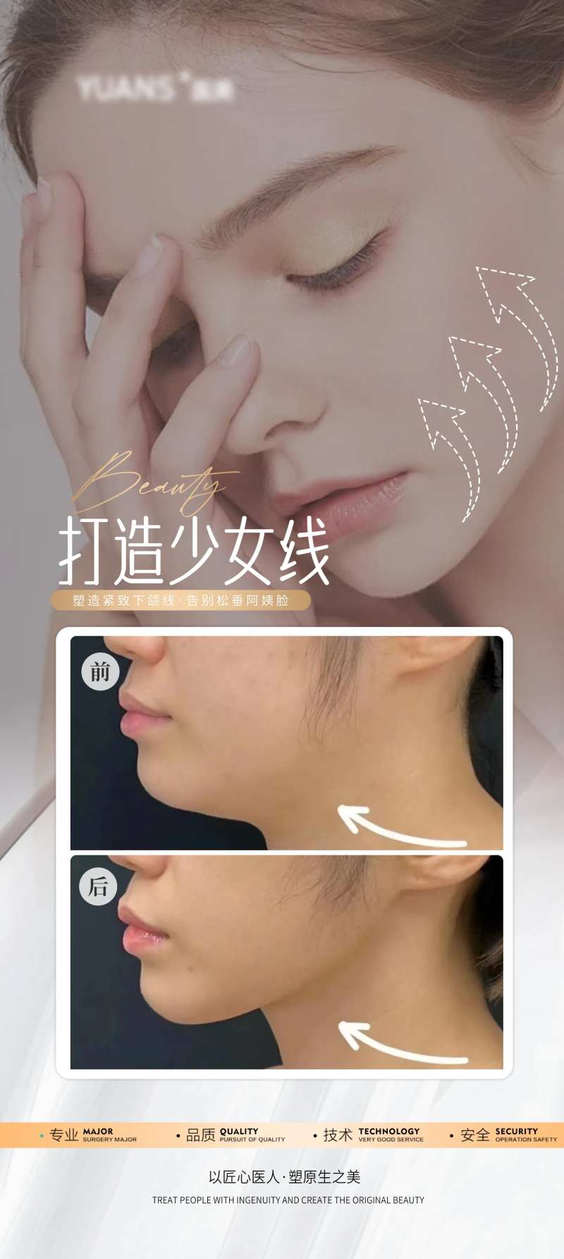 医美下巴案例对比图-采灵感-cailinggan.com