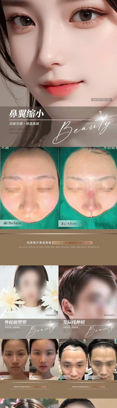 整形植发案例集-采灵感-https://www.cailinggan.com/