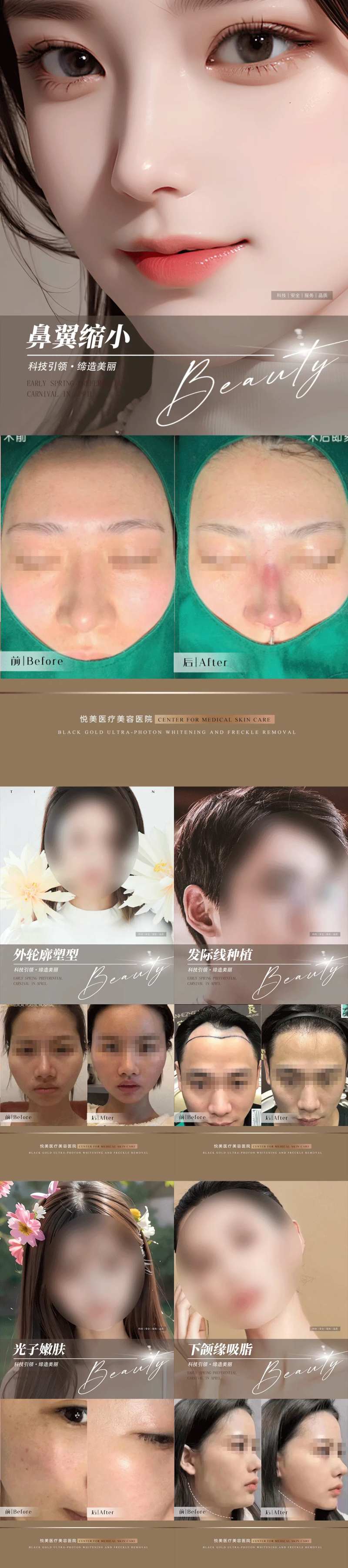 整形植发案例集-采灵感-cailinggan.com