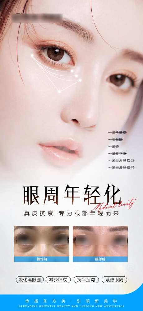 医美眼周年轻化案例对比海报-采灵感-https://www.cailinggan.com/