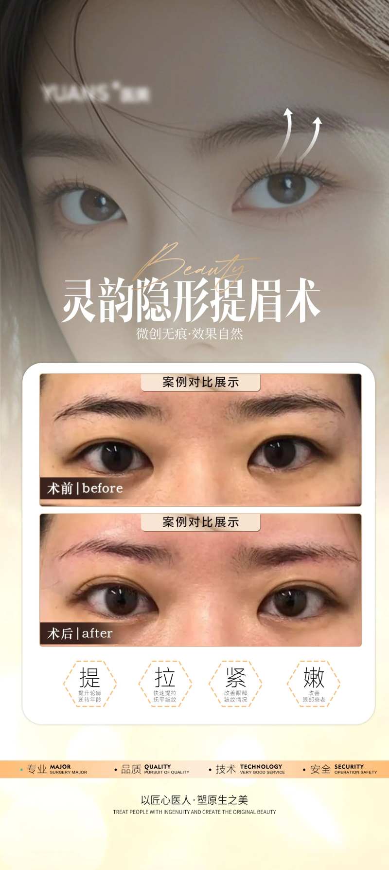 医美提眉案例科普-采灵感-cailinggan.com