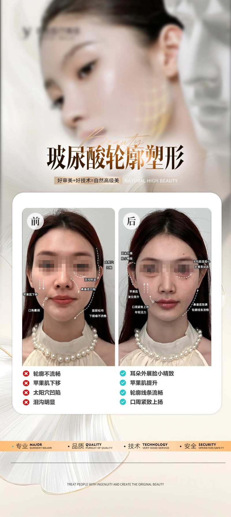 医美玻尿酸外轮廓填充案例海报-采灵感-cailinggan.com