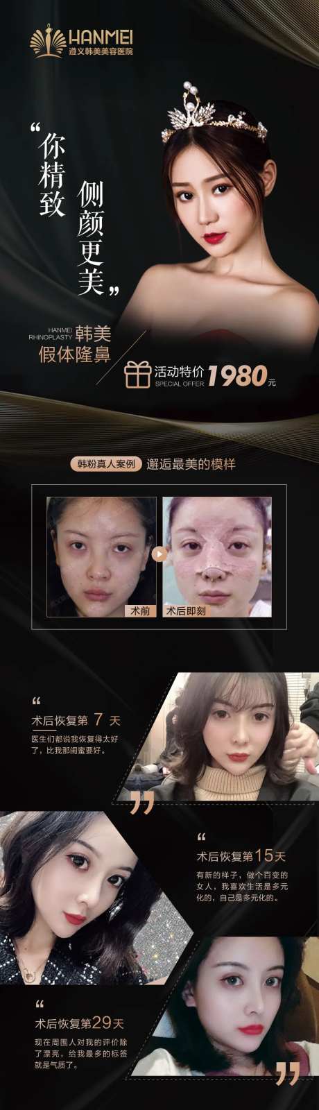 医美整形美容肋软骨隆鼻海报微信图-采灵感-https://www.cailinggan.com/