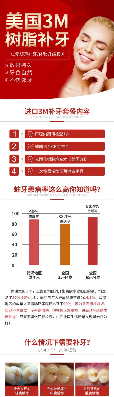 美国3M补牙详情-采灵感-https://www.cailinggan.com/