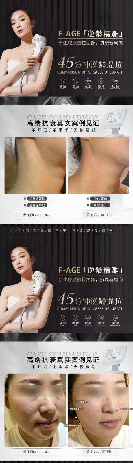 医美人物海报 7d光电案例海报-采灵感-https://www.cailinggan.com/