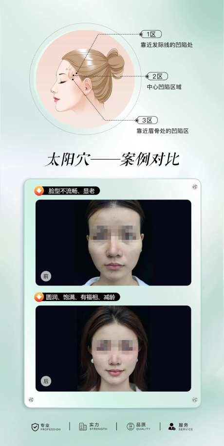 太阳穴案例对比海报-采灵感-https://www.cailinggan.com/