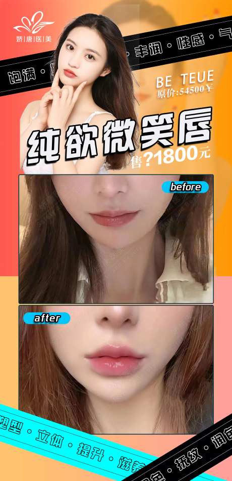 医美整形微笑唇-采灵感-https://www.cailinggan.com/