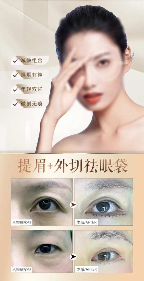 提眉祛眼袋案例-采灵感-https://www.cailinggan.com/